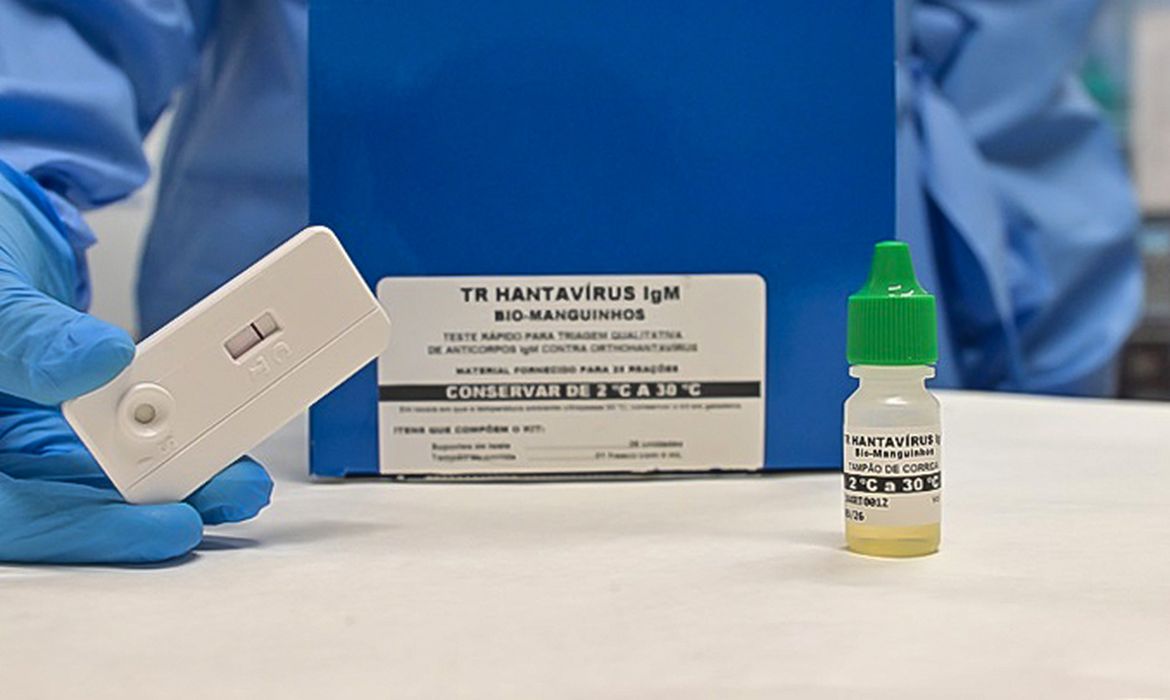 OAB Barro Preto - Novo teste faz diagnóstico de hantavirose em 20 minutos